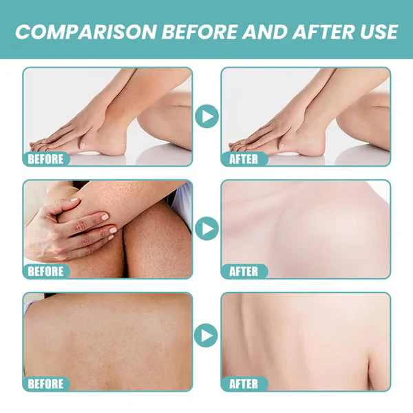 ChronoLux Body Oil - Silky Skin & A Bug-Free Evening - 50% OFF - Image 5