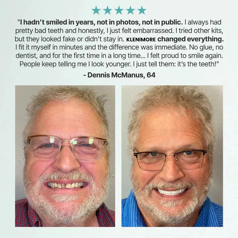 KLENIMORE™ - A Perfect Natural Smile Instantly- UP TO 50% OFF - Image 11