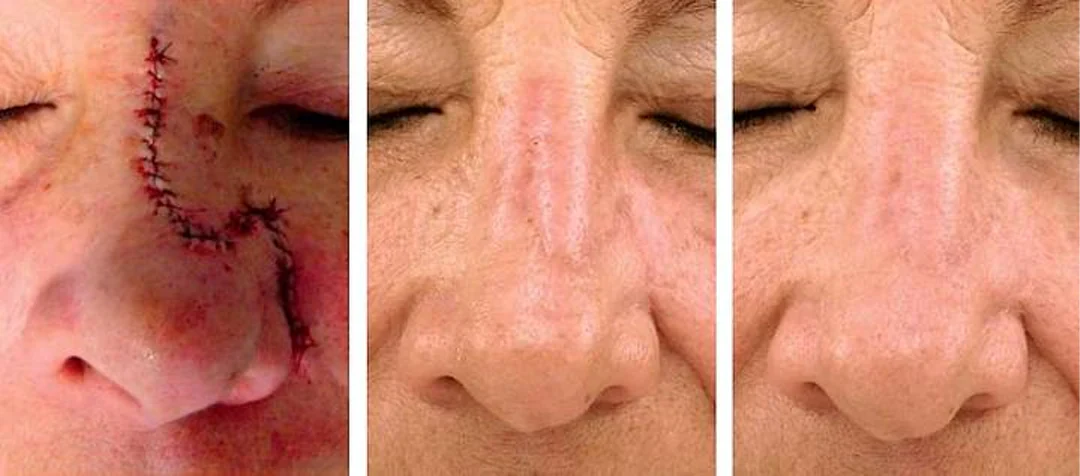 ScarRefine – Erase Scars & Restore Texture + 50% OFF TODAY - Image 9