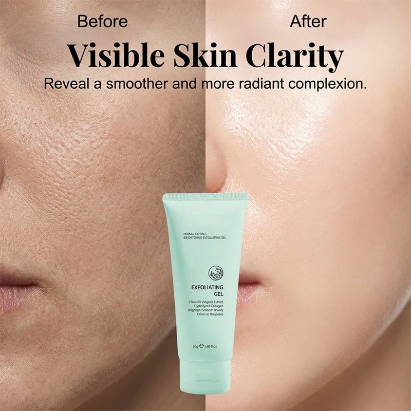 Dewveil™ – Herbal Aloe Exfoliating Gel for Deep Pore Cleansing & Glow + BUY 1+  GET 1 FREE - Image 6