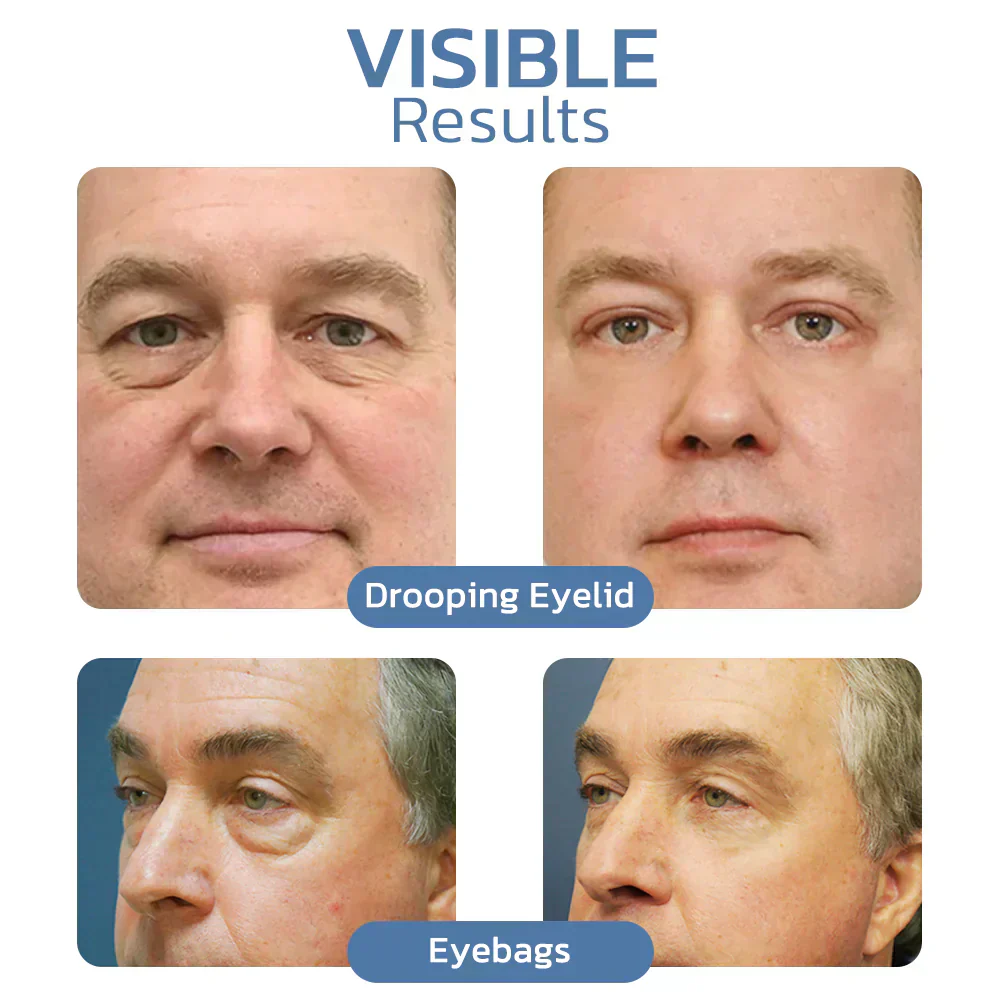 The AuraLift Peptide Eye Gel - Awaken Peptide Lifting Formula + 50% OFF - Image 5