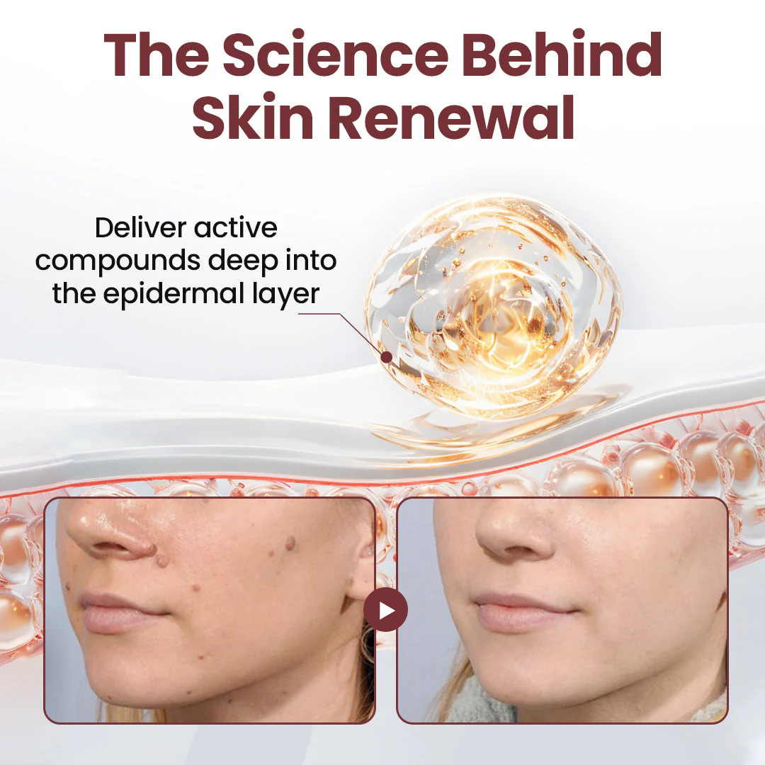 The KeraErase Dual-Action Cream - Non-Acidic Renewal for Warts, Tags, and Keratin Buildup + 50% OFF - Image 4