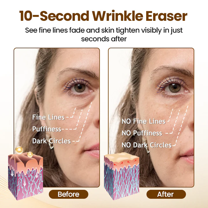 Lift10 - Erase Wrinkles in 10 Seconds + 50% OFF - Image 2