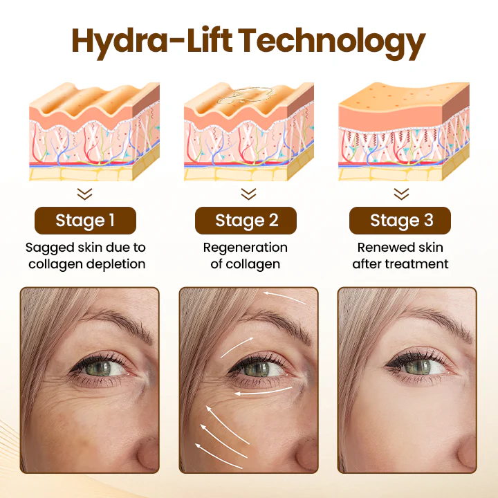 Lift10 - Erase Wrinkles in 10 Seconds + 50% OFF - Image 3