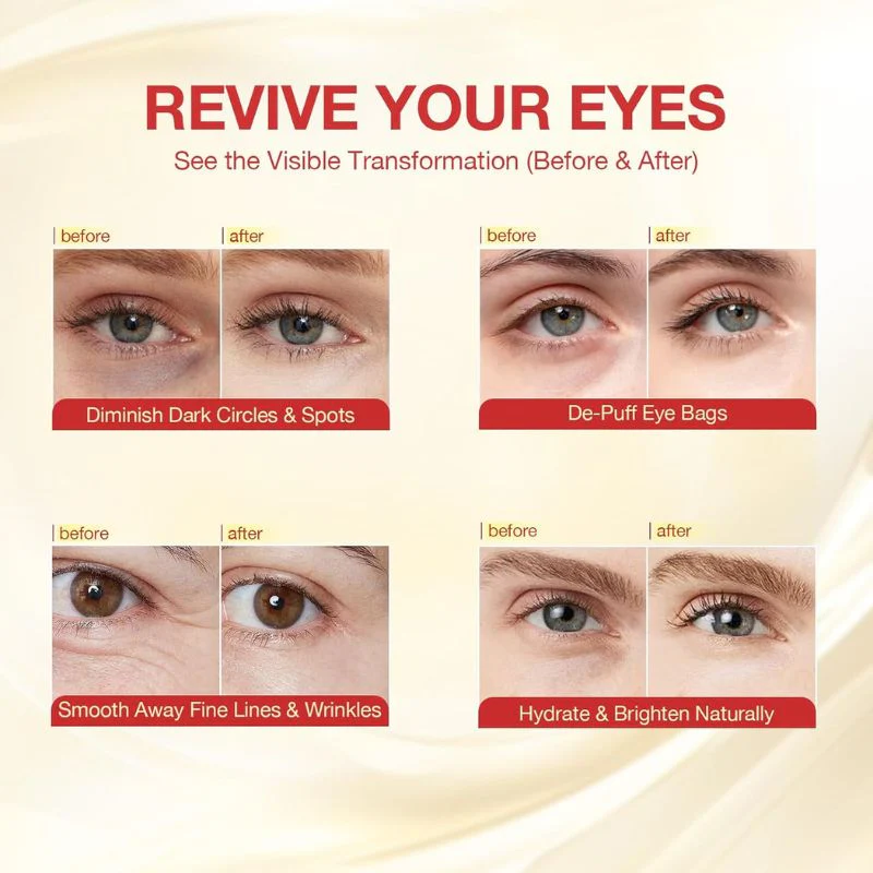 Lumineye - Reverse Years Of Eye Aging In Minutes + 50% Off - Image 5