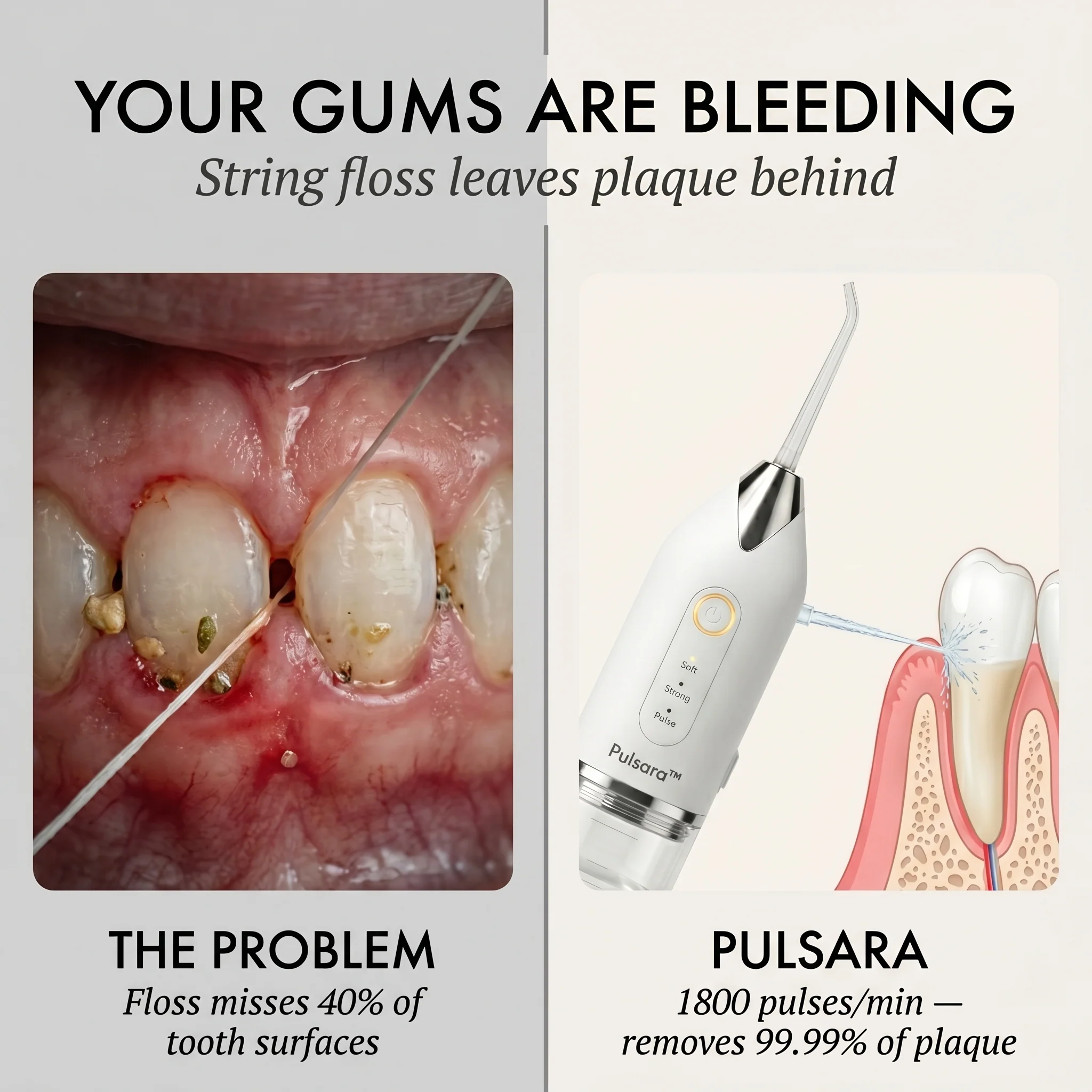 Pulsara™ – 4-Tip Portable Water Flosser for Deep Gum & Teeth Cleaning + 50% OFF - Image 4
