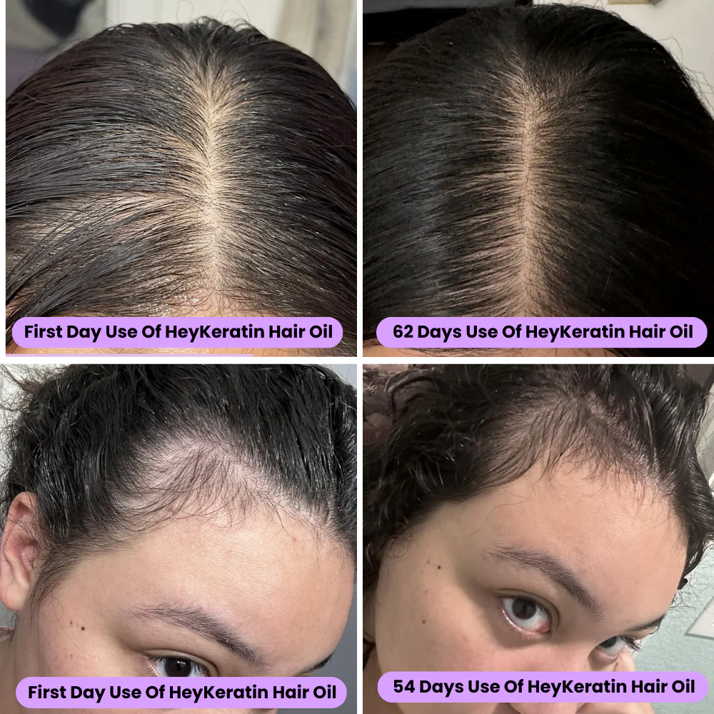 RootRenew Elixir - Reclaim Your Hair's Fullness - 50% OFF - Image 3