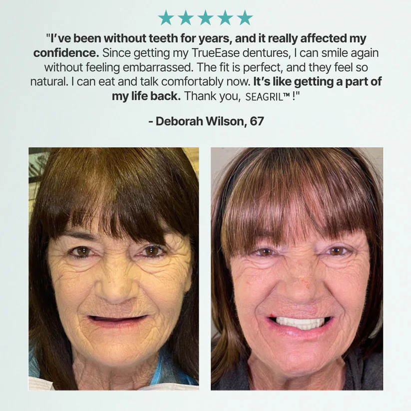 The FlexFit Adaptive Dentures - Custom Fit, Functional, and Natural Look +50% OFF! - Image 3