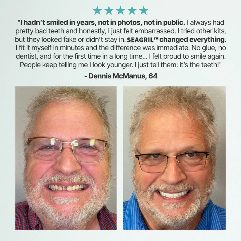 The FlexFit Adaptive Dentures - Custom Fit, Functional, and Natural Look +50% OFF! - Image 5