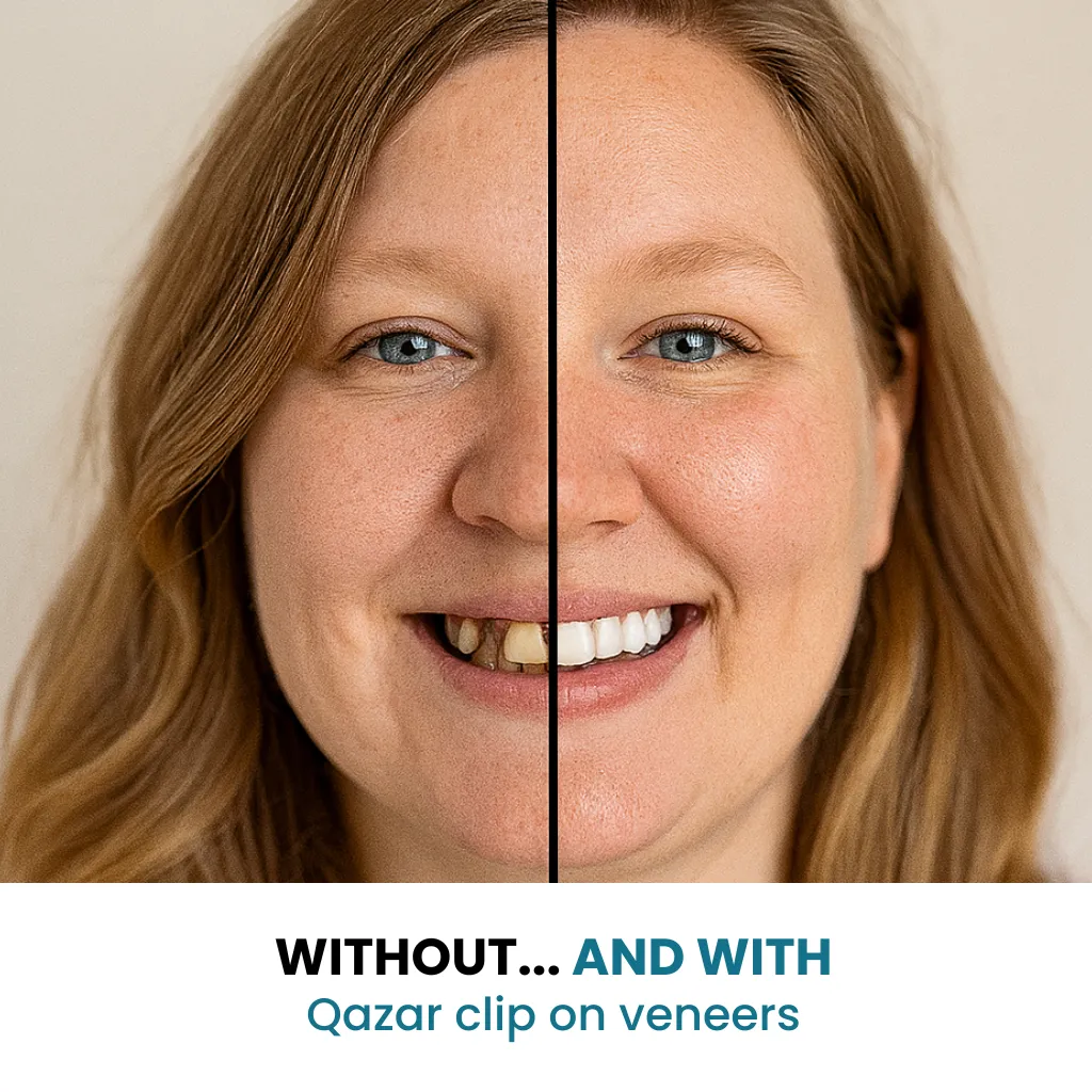 SecureSmile - Your Perfect Smile, in 5 Minutes - 50% OFF - Image 4