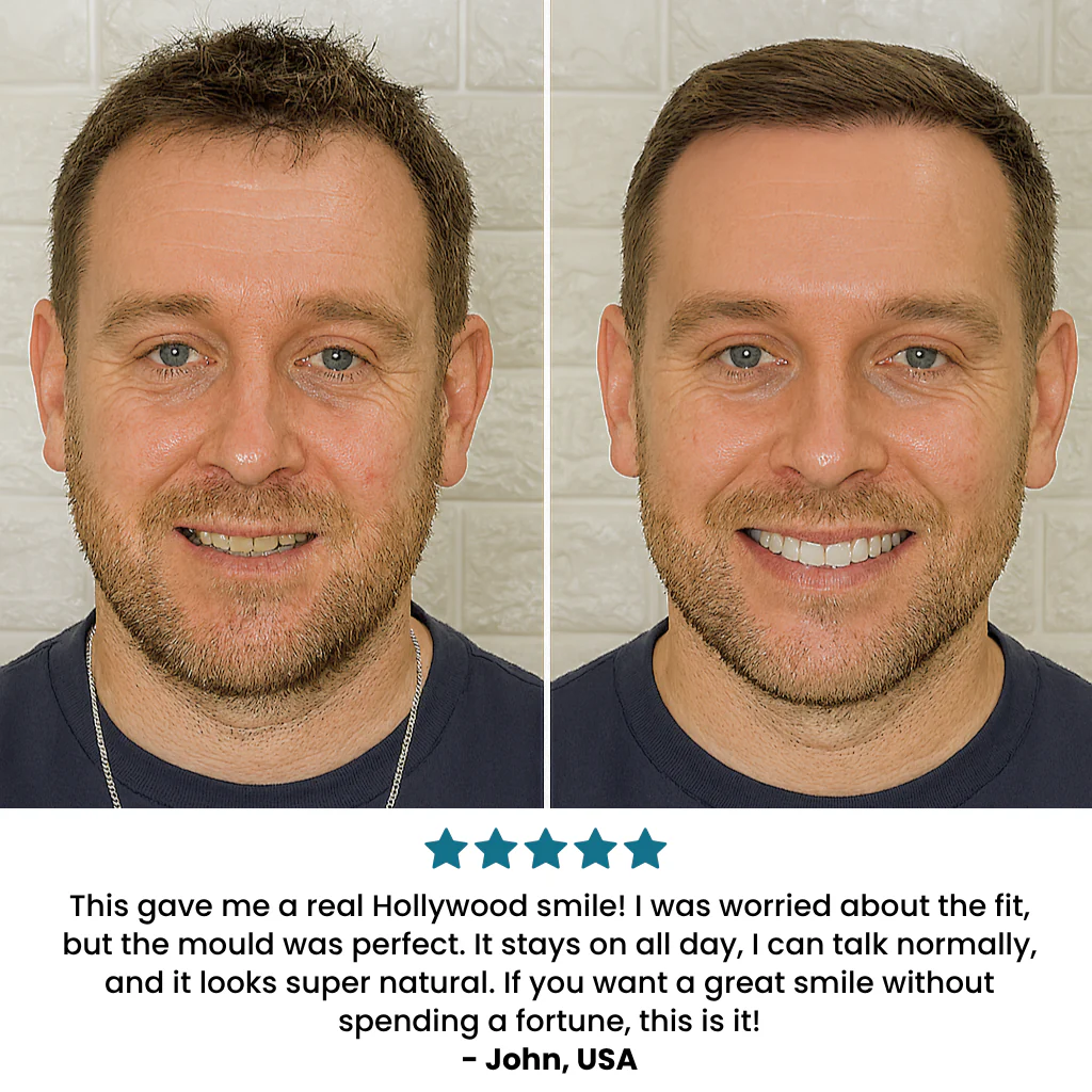 SecureSmile - Your Perfect Smile, in 5 Minutes - 50% OFF - Image 7