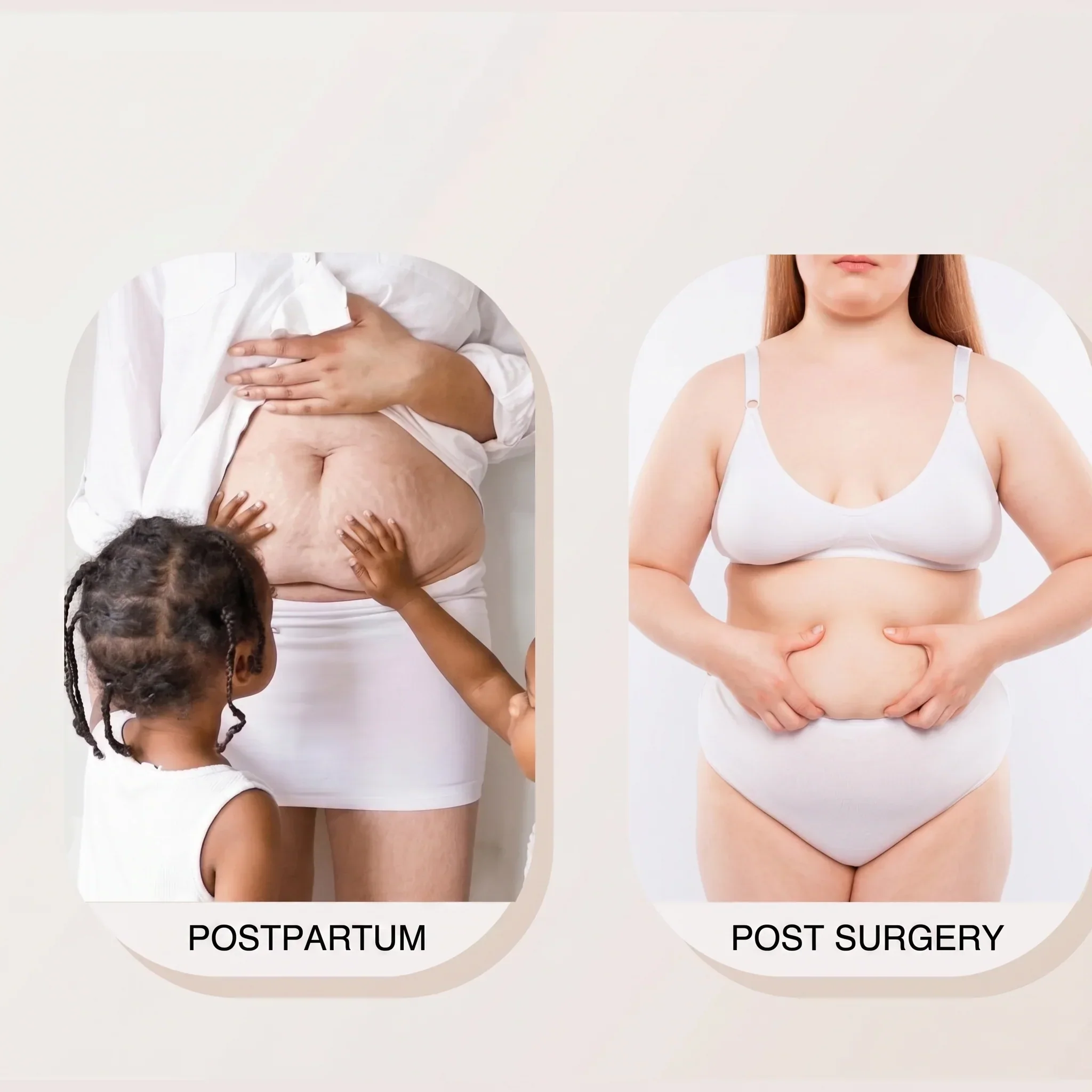 Poise™ – Dual-Zip Tummy Control Shapewear Bodysuit with Anti-Slip Lace + 50% OFF - Image 6