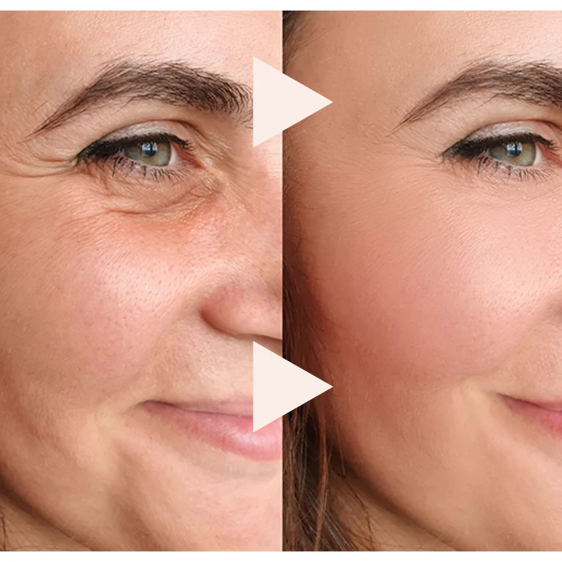 RevitaStick – Smooth Wrinkles Instantly + 50% OFF - Image 6