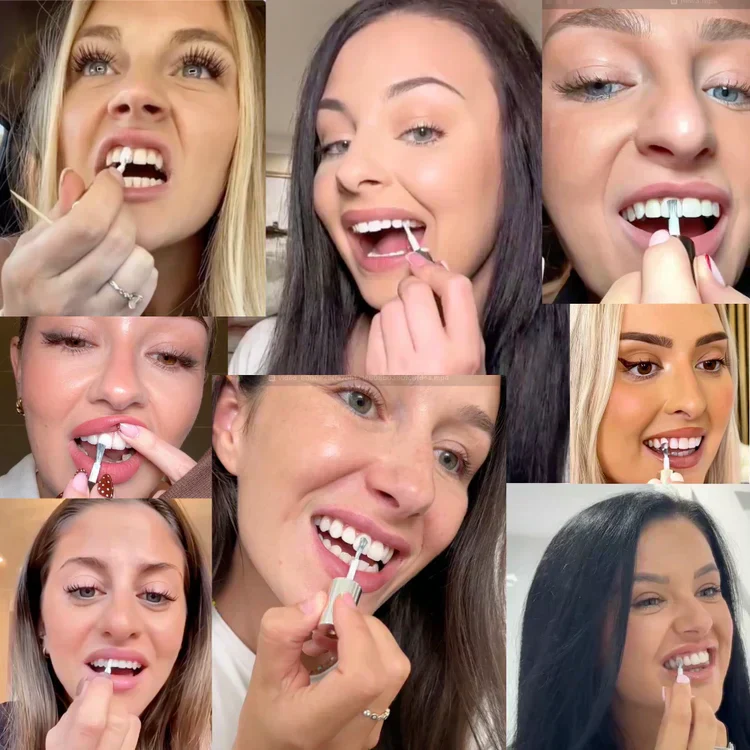 The AuraGlow Tooth Polish — Instant Radiance for a Brighter Smile + 50% OFF - Image 4