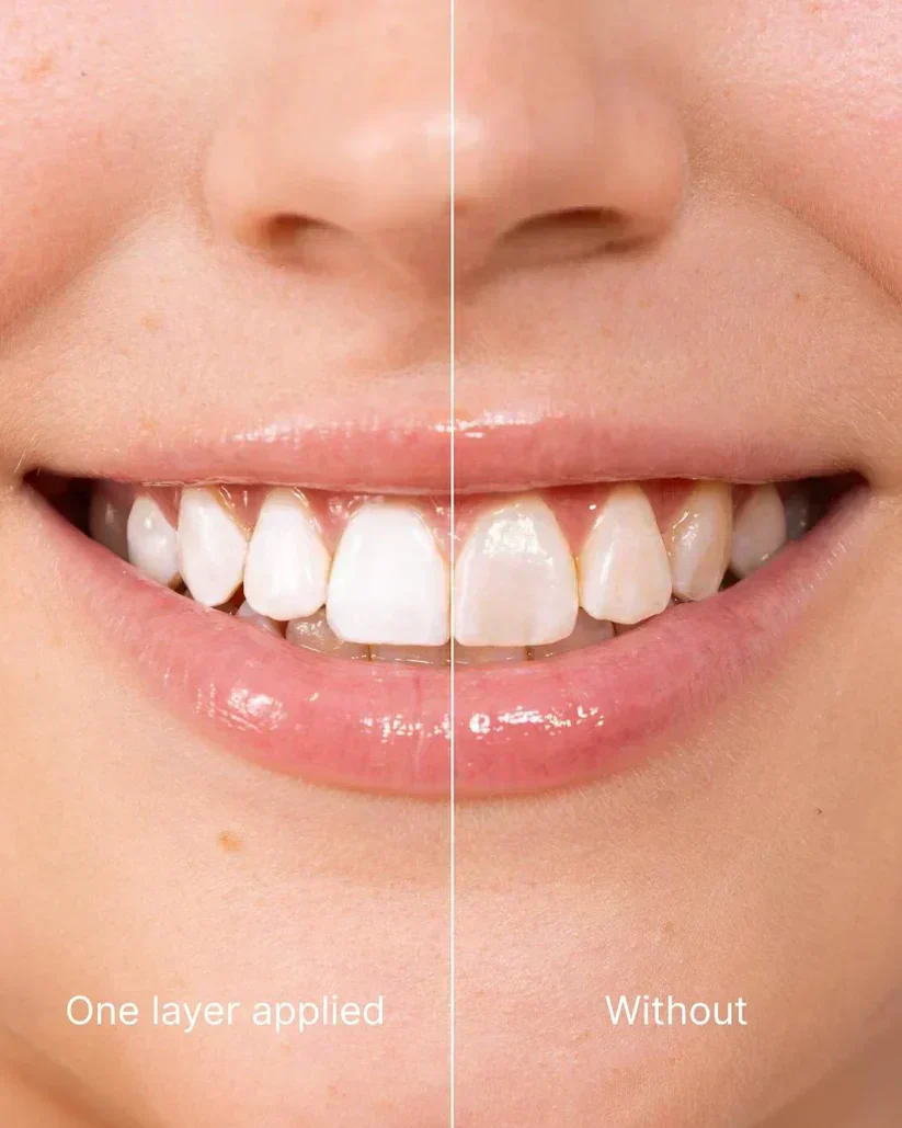 The AuraGlow Tooth Polish — Instant Radiance for a Brighter Smile + 50% OFF - Image 6