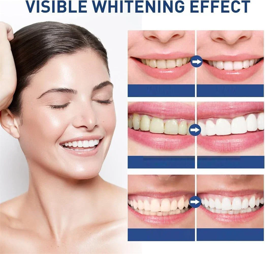 The AuraGlow Tooth Polish — Instant Radiance for a Brighter Smile + 50% OFF - Image 9